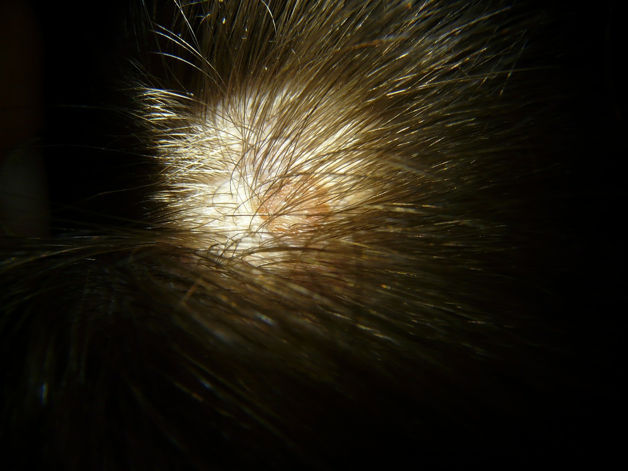 Read more about the article The dandruff states of the scalp